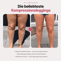 LESIRA | 3D Shaping-Kompressionsleggings